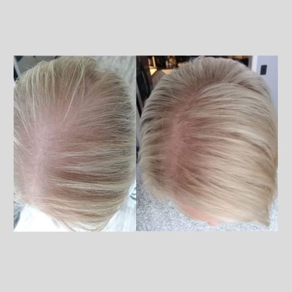 PhiloSophie Hair - Before and After shots of hair growth