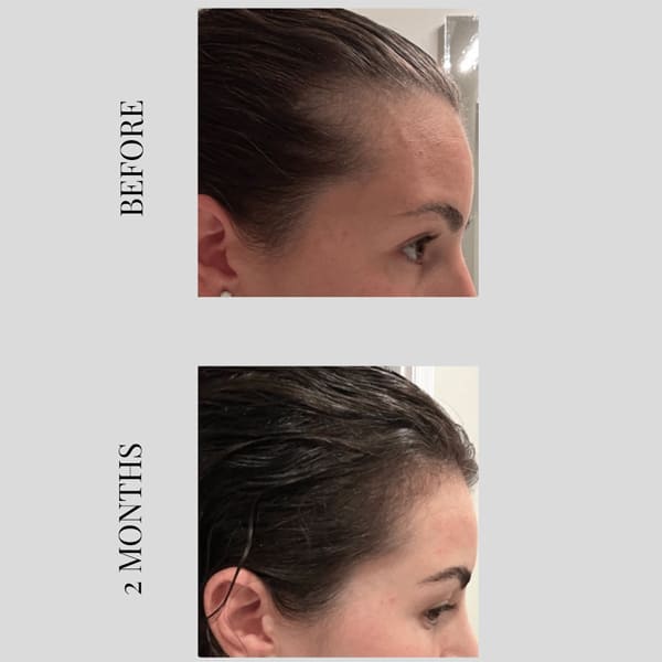 PhiloSophie Hair - Before and After shots of hair growth