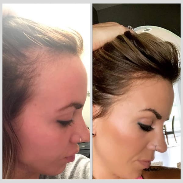 PhiloSophie Hair - Before and After shots of hair growth