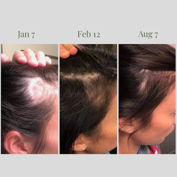 PhiloSophie Hair - Before and After shots of hair growth