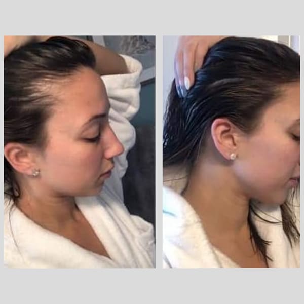 PhiloSophie Hair - Before and After shots of hair growth