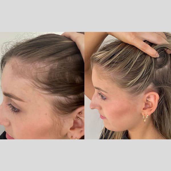 PhiloSophie Hair - Before and After shots of hair growth