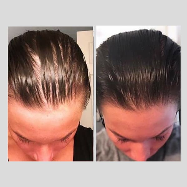 PhiloSophie Hair - Before and After shots of hair growth