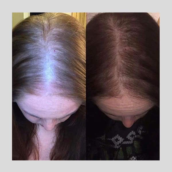 PhiloSophie Hair - Before and After shots of hair growth