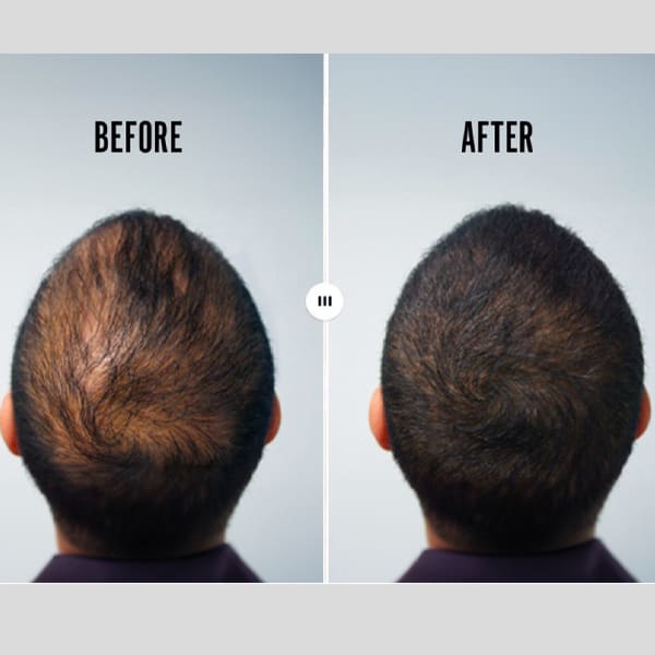 PhiloSophie Hair - Before and After shots of hair growth